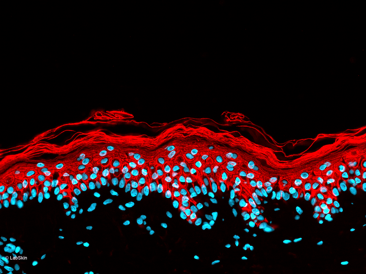 CYTOKERATINE 10 CK-10 LabSkin Explorer