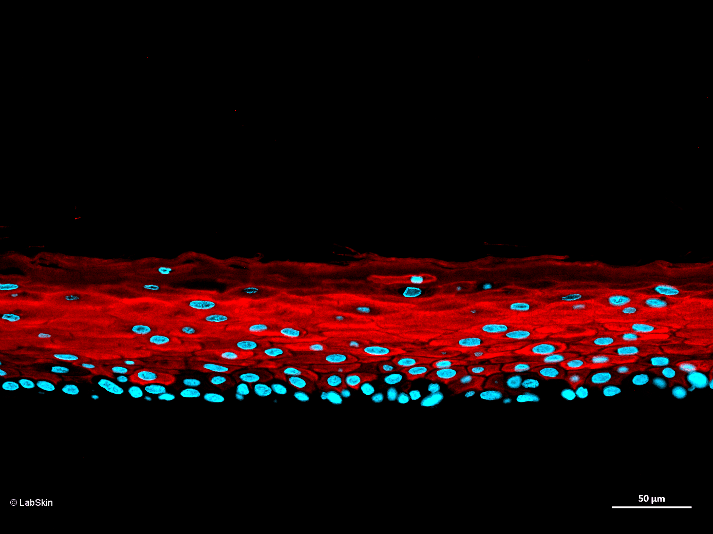 CYTOKERATINE 10 CK-10 LabSkin Explorer