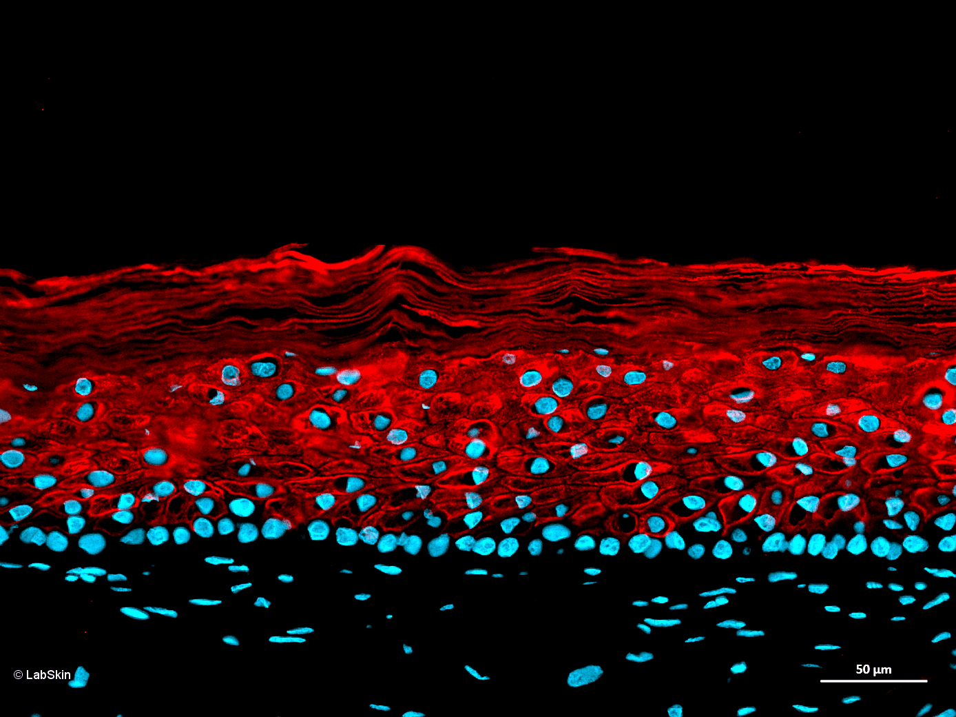 CYTOKERATINE 10 CK-10 LabSkin Explorer