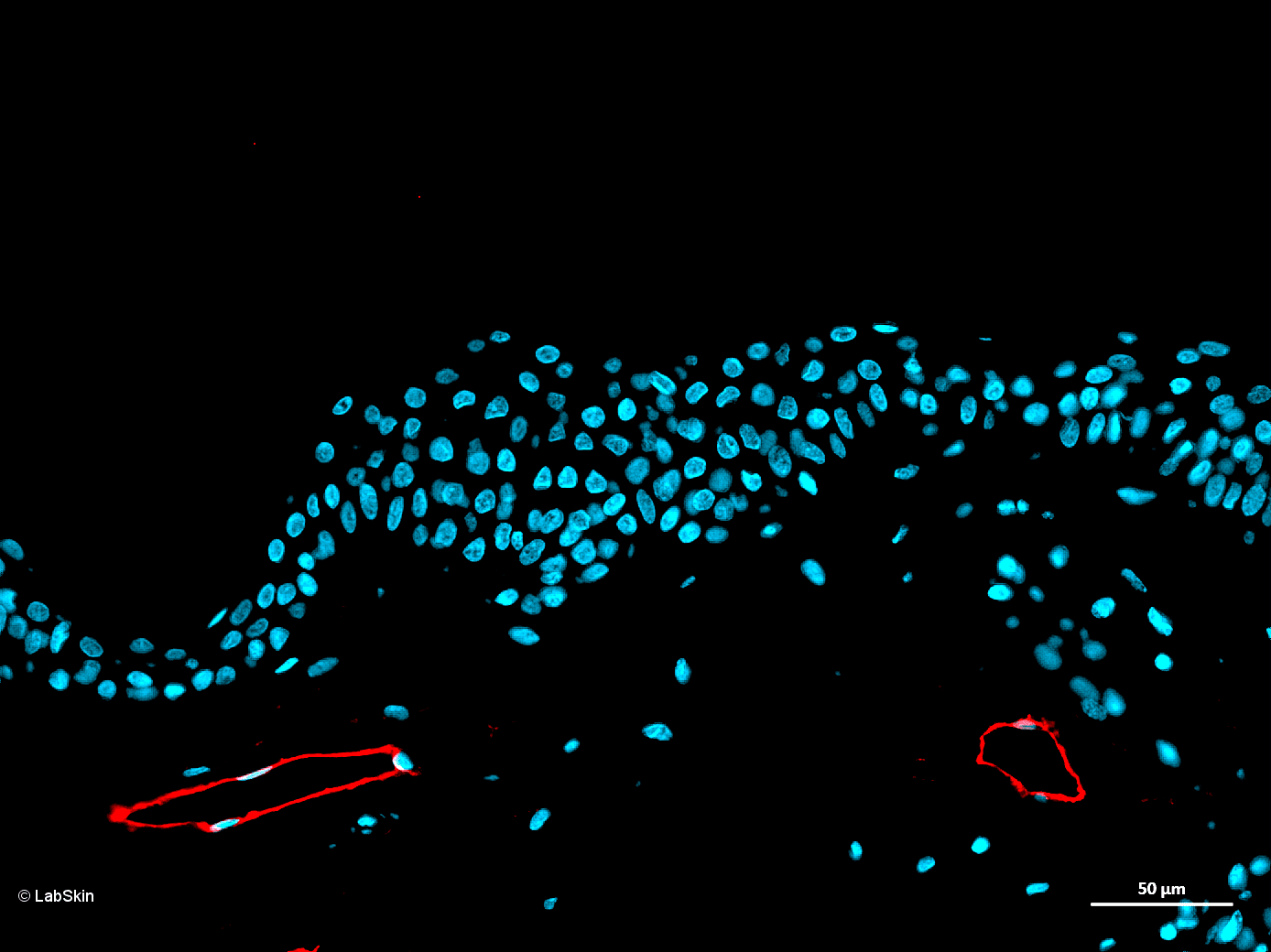 PODOPLANIN LabSkin Explorer